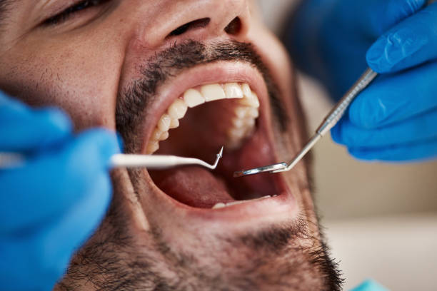 Best Emergency Denture Repair in Butler, NJ