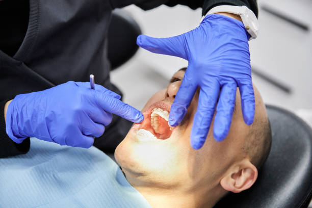Best Emergency Treatment for Oral Infections in Butler, NJ