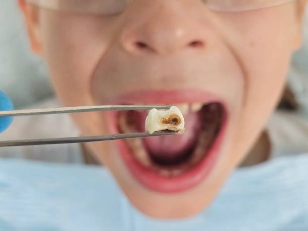 Best Emergency Pediatric Dental Care in Butler, NJ